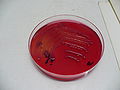 Escherichia coli, Endo agar