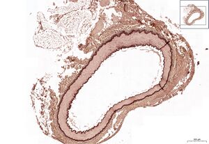 Muscle artery RF 2,7x.jpg
