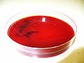 Neisseria pharyngis, blood agar