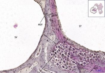 Organum vestibulocochleare HE 16x.jpg