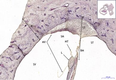 Organum vestibulocochleare HE 5,6x.jpg