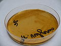 Proteus vulgaris,thiosulfate-citrate-bile salts-sucrose agar (TCBS)