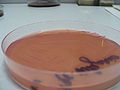 Proteus vulgaris, Endo agar
