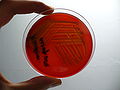 Pseudomonas aeruginosa, blood agar