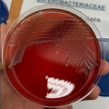 Salmonella enterica, blood agar