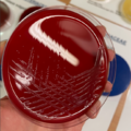 Shigella flexneri, blood agar