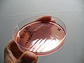 Shigella flexneri, thiosulfate-citrate-bile salts-sucrose agar (TCBS)