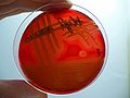 Staphylococcus aureus, blood agar, β-hemolysis detail