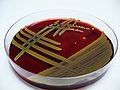 Staphylococcus aureus, blood agar
