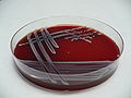 Staphylococcus epidermidis, blood agar