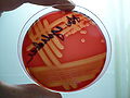 Streptococcus agalactiae, blood agar, β-hemolysis detail
