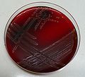 Streptococcus agalactiae, blood agar