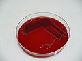 Yersinia enterocolitica, blood agar