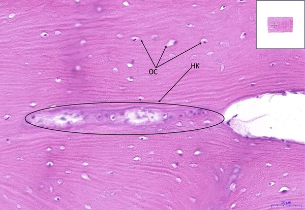 Lamellar bone, HE 20x.jpeg