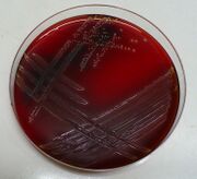Streptococcus agalatiae-blood agarkkmk.jpg