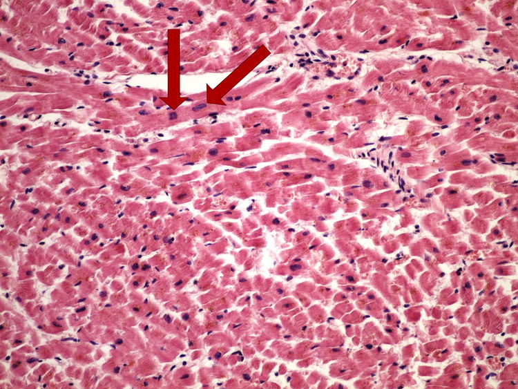 HE (myocardium) HE (myokard) 20x..jpg