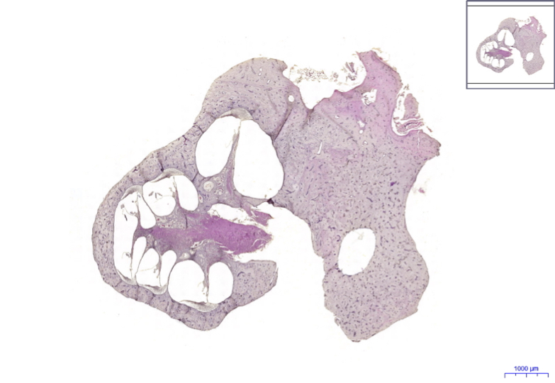 Organum vestibulocochleare HE 0,8x.jpg
