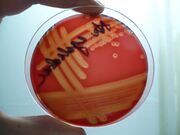 Streptococcus agalatiae-krevni agar-hemolysis.jpg