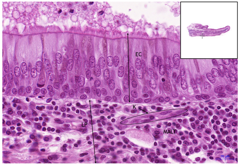 Epiglottis, HE 40x