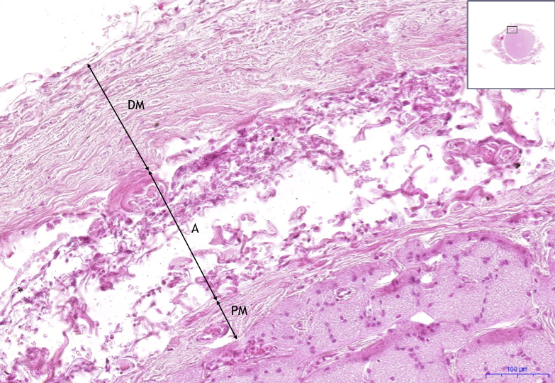 Nervus opticus – HE, 11,7x.png