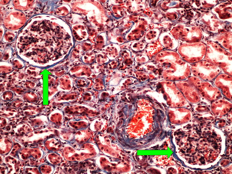 Z1-3 blue trichrome (kidney) modry trichrom (ledvina) 20x oznaceno.jpg