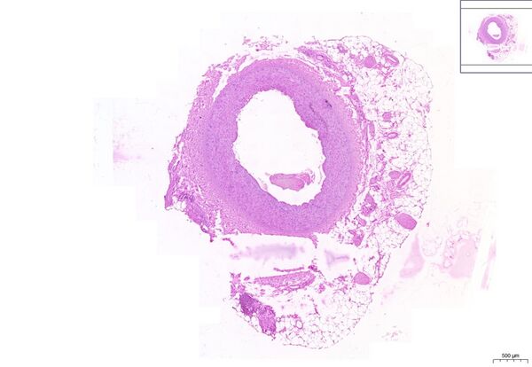 Muscle artery HE 1,9x.jpg