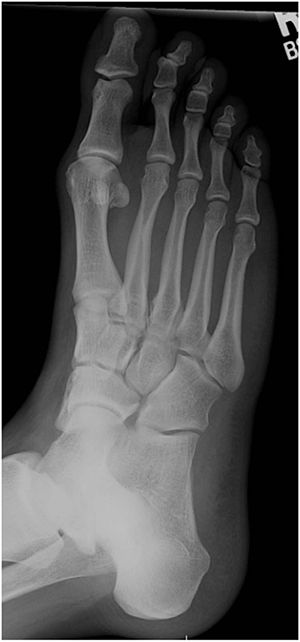 Px-Radiografía plantar.jpg
