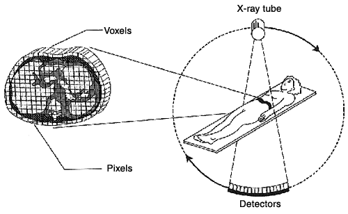 COMPUTED TOMOGRAPHY (CT) - WikiLectures