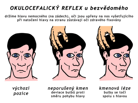 Impaired consciousness and seizures (paediatrics) - WikiLectures