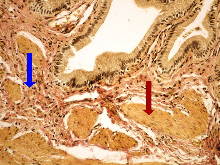 Z1-4 van Gieson (gallbladder) van Gieson (zlucnik) 20x oznaceno.jpg