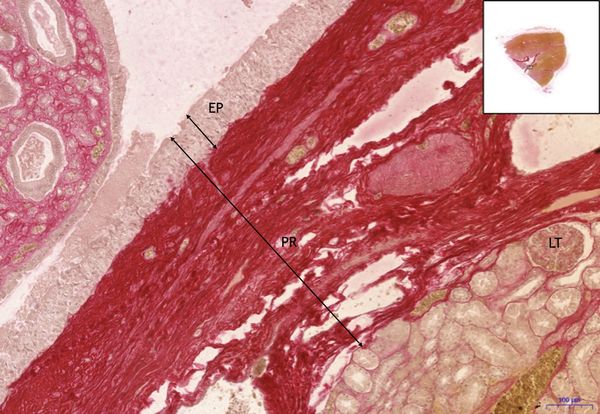 Kidney-Kidney, WvG 5x.jpeg