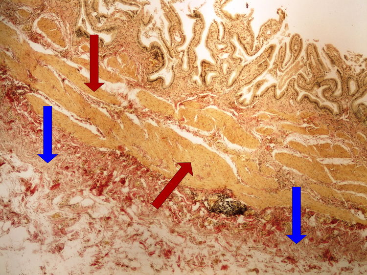 Z1-4 van Gieson (gallbladder) van Gieson (zlucnik)4x oznaceno.jpg