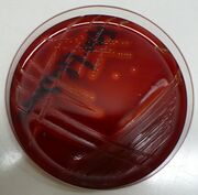 Streptococcus pyogenes-blood agar4mf4k.jpg