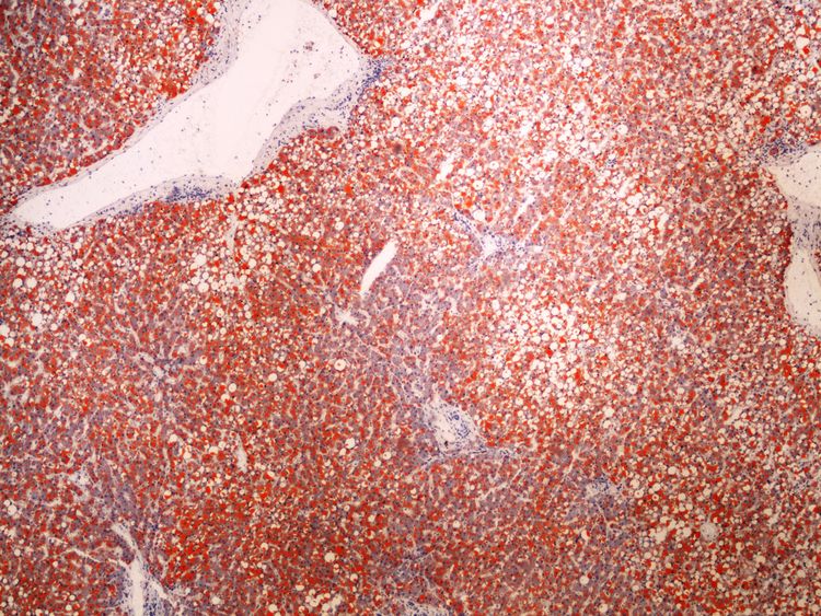 Lipid staining (liver) prukaz tuku (jatra) 4x.jpg