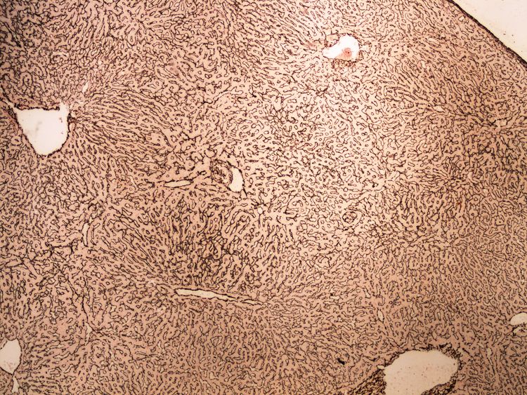 Reticulum (liver) retikulum (jatra) 4x.jpg