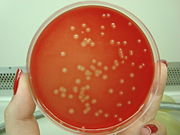Streptococcus agalactiae cfcfk.jpg