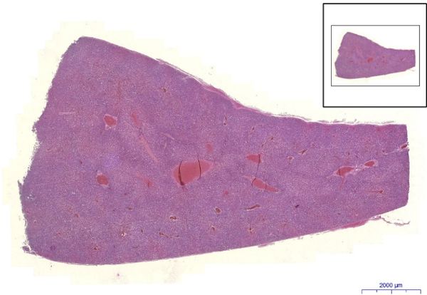 Játra- Liver, HE 0,7x.jpeg