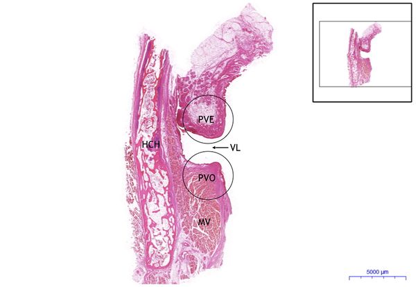 Larynx HE, 0.3x.jpeg