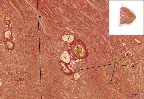 Kidney-Kidney, WvG 10xjpeg.jpeg