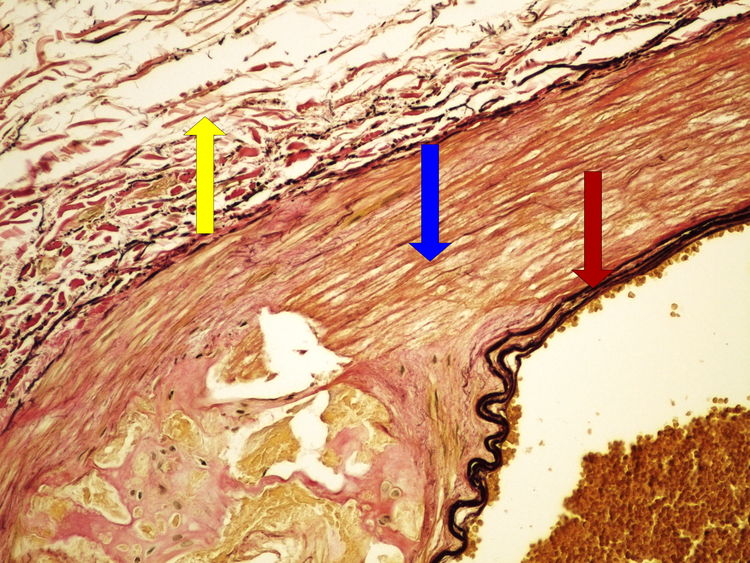Preparation No. 2 - van Gieson staining (elastic fibers).png