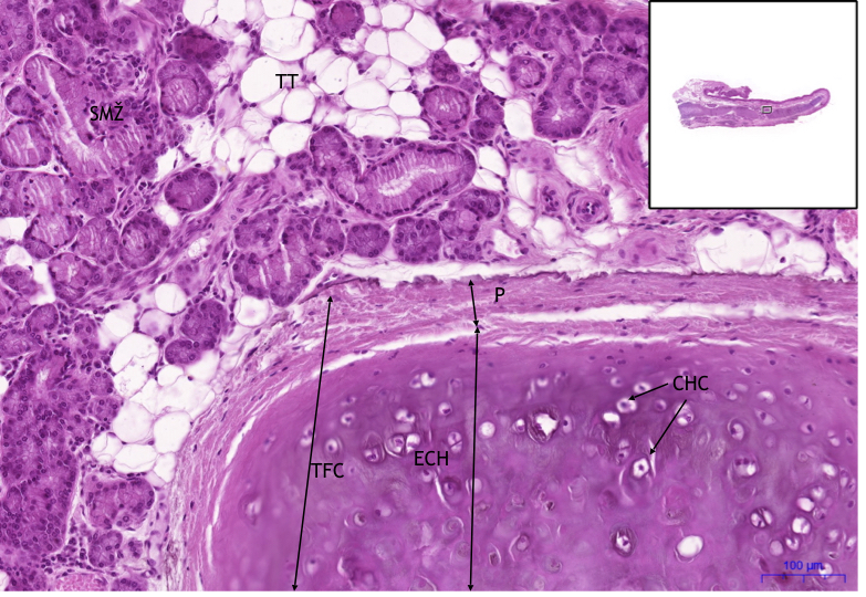 Epiglottis, HE 10x