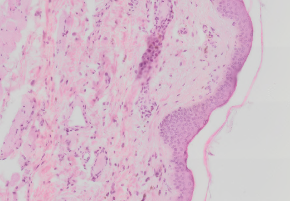 Thin Type of Skin.png