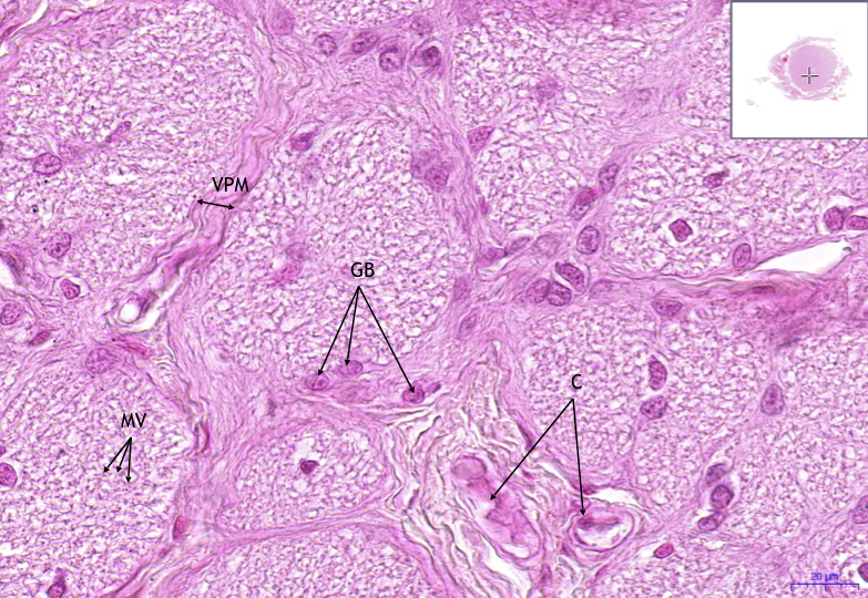 Nervus opticus – HE, 40x.png
