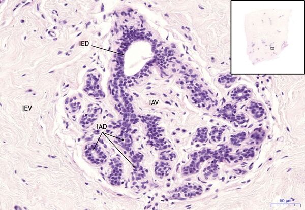 Mamma non lactans, HE 20x.jpeg