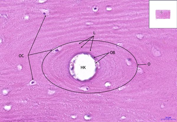 Lamellar bone, HE 40x.jpeg