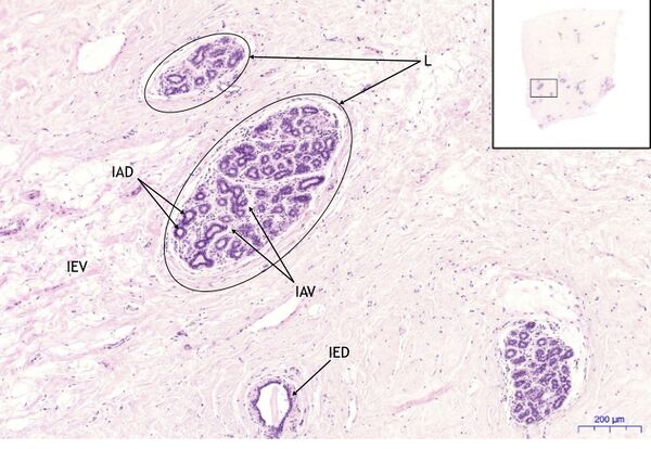 Mamma non lactans, HE 5x.jpeg