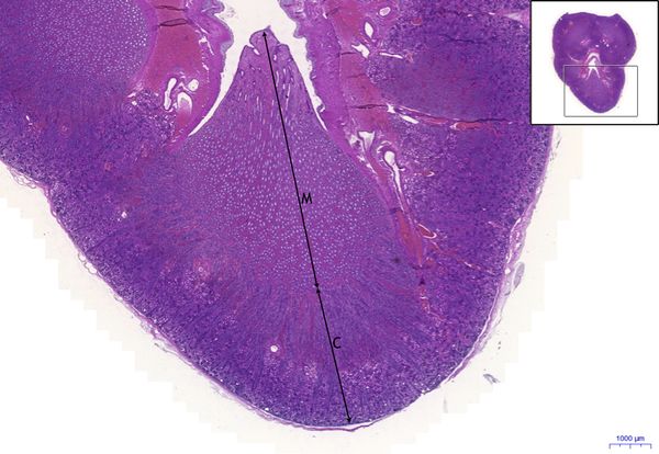 Kidney/Kidney, HE 2x
