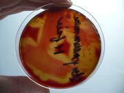 Streptococcus pneumoniae M-phase-blood agar-detail hemolysis.jpg