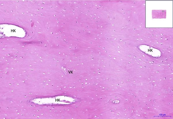 Lamellar bone, HE 10x.jpeg