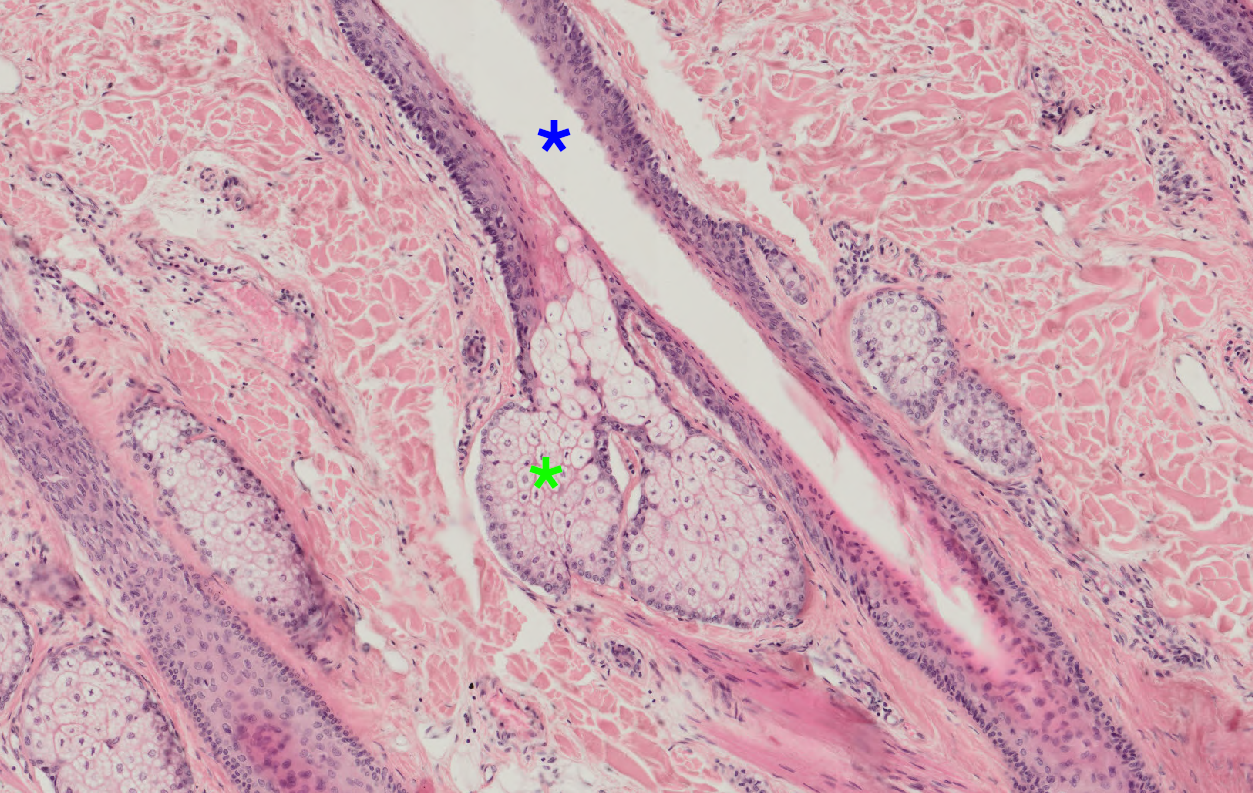 Skin Sebaceous.png